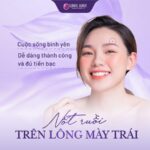 Luận giải vị trí 20 nốt ruồi phú quý trên mặt phụ nữ hút tài lộc