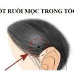 20 nốt ruồi phú quý giàu “nứt vách đổ tường”  ở nam, nữ